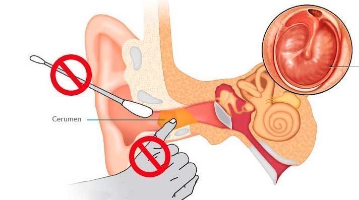 Cerumen
